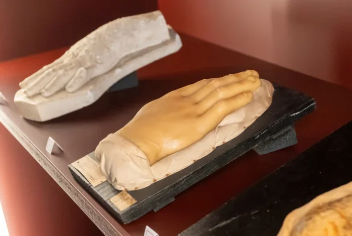 Coolturalia - Objets de savoir, objets de fierté - les moulages médicaux